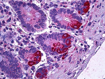 IL12A/p35 Antibody
