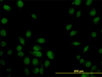 SP1 Antibody