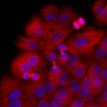 TUBB/Beta Tubulin Antibody
