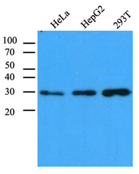 CBR/CBR1 Antibody