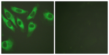 RPS6/Ribosomal Protein S6 Antibody