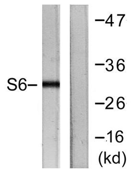 RPS6/Ribosomal Protein S6 Antibody