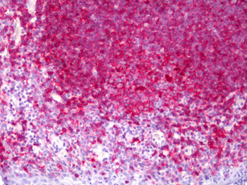 MHC Class II Antibody