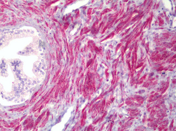 TMEPAI/PMEPA1 Antibody