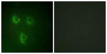 TMEPAI/PMEPA1 Antibody