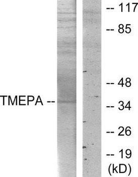 TMEPAI/PMEPA1 Antibody