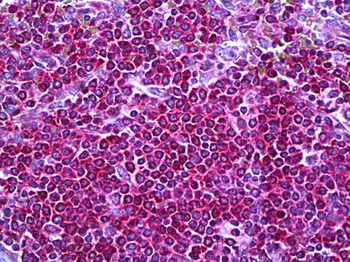 Neurofibromin/NF1 Antibody