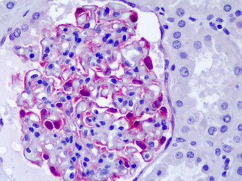 CLIC5 Antibody