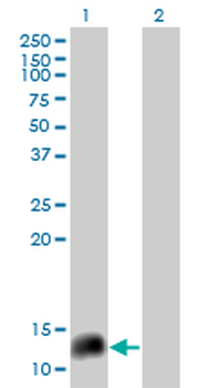 Neuropeptide Y/NPY Antibody
