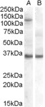 AGO1/EIF2C Antibody