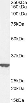 ABRI/ITM2B Antibody