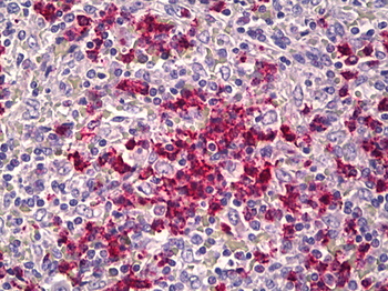 CDH23/Cadherin 23 Antibody