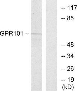 GPCR6/GPR101 Antibody