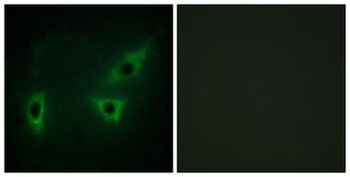 WC1/ATP7B Antibody