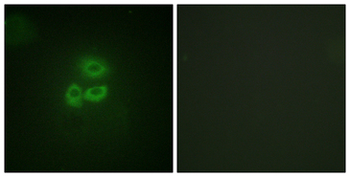 PRKD1/PKC Mu Antibody
