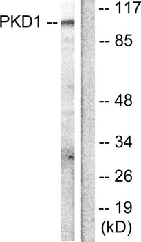 PRKD1/PKC Mu Antibody