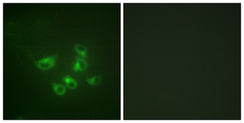 TPH1/Tryptophan Hydroxylase Antibody