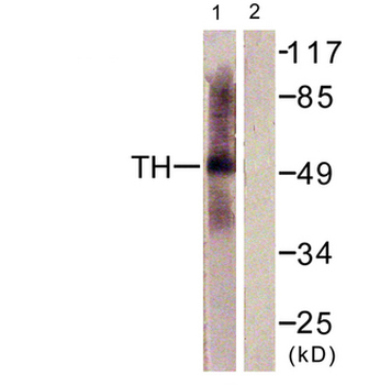 TPH1/Tryptophan Hydroxylase Antibody