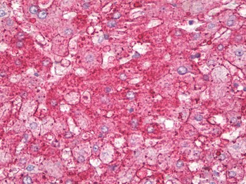 ANXA6/Annexin A6/Annexin VI Antibody