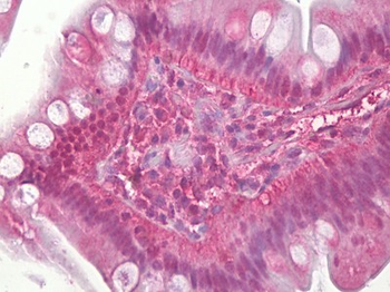 FOS/c-FOS Antibody