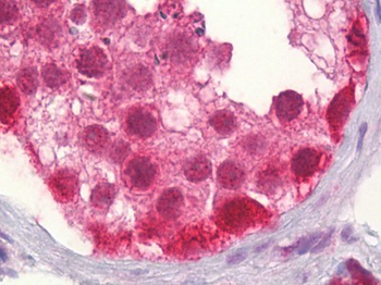 CUL2/Cullin 2 Antibody