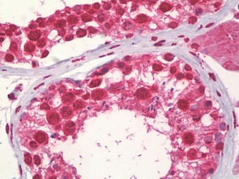 CCNA1/Cyclin A1 Antibody