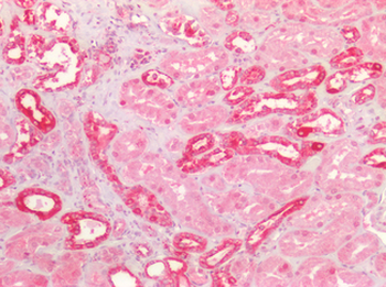 AXIN2/Axin 2 Antibody