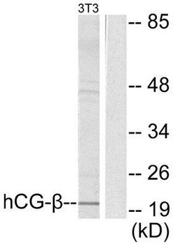 CGB/hCG Beta Antibody