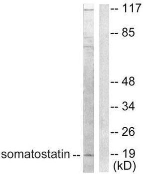SST/Somatostatin Antibody