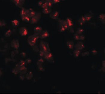 EZH2 Antibody