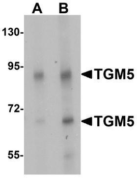 TGM5/Transglutaminase 5 Antibody