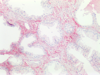 CD81 Antibody
