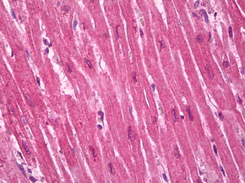 PPARG/PPAR Gamma Antibody