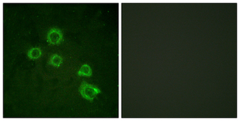 PLA2G4A Antibody