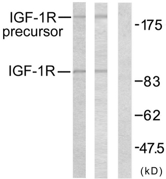 IGF1R/IGF1 Receptor Antibody