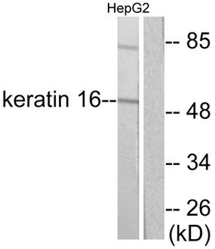 KRT16/CK16/Cytokeratin 16 Antibody