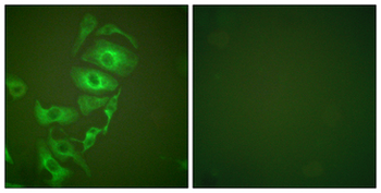KRT17/CK17/Cytokeratin 17 Antibody