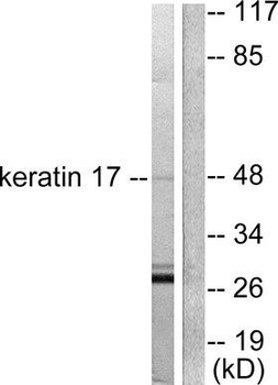 KRT17/CK17/Cytokeratin 17 Antibody