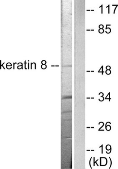 KRT8/CK8/Cytokeratin 8 Antibody