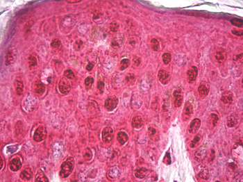 GAPDH Antibody