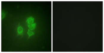 RPS6KA5/MSK1 Antibody