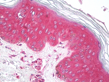 MNK/ATP7A Antibody