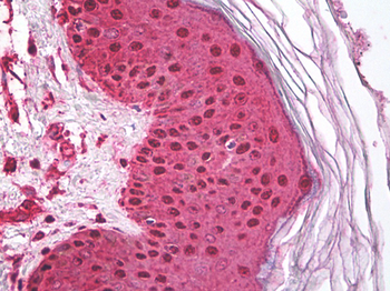 HSP70/Heat Shock Protein 70 Antibody