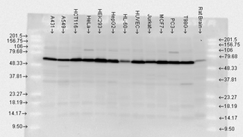 HSP70/Heat Shock Protein 70 Antibody