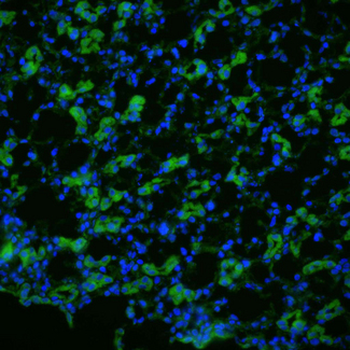 AQP1/Aquaporin 1 Antibody