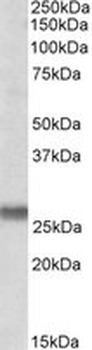 SNAP23/SNAP-23 Antibody