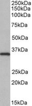 NEK7 Antibody