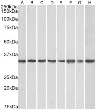 GNB2L1/RACK1 Antibody