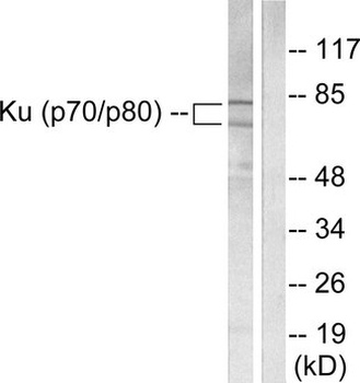Ku70+Ku80/XRCC6+XRCC5 Antibody