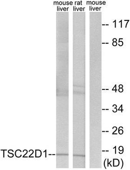 TSC22D1/TSC22 Antibody